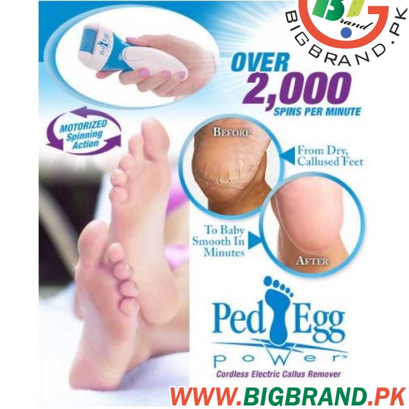 http://bigbrand.pk/image/data/z99389/Ped%20Egg%20Power%20Callus%20Remover%20in%20Pakistan-4.jpg